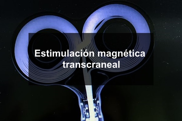 Estimulación Magnética Transcraneal